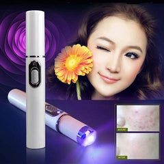 "Blue Light Acne Laser Treatment Pen"